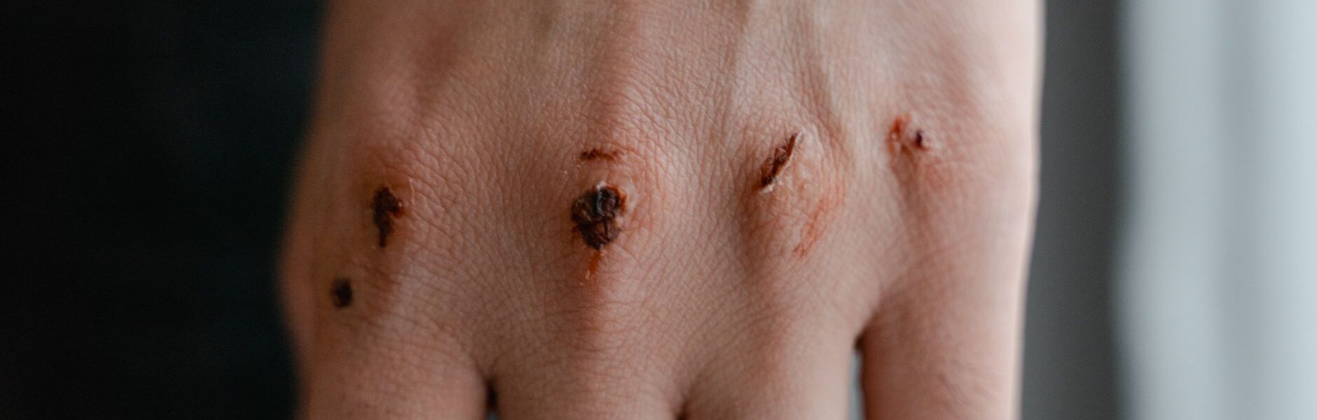 Barcelona defensive duo injury