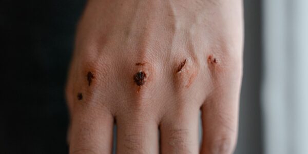 Barcelona defensive duo injury